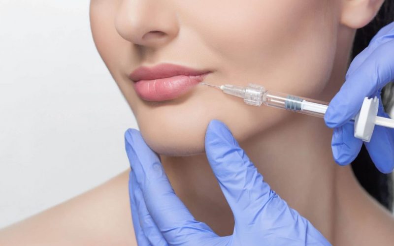 Saiba-como-funciona-o-preenchimento-com-acido-hialuronico-1092x728-1